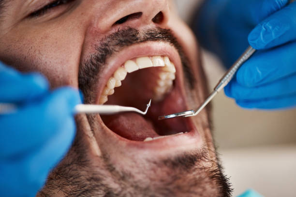 Best Emergency Tooth Extraction in De Witt, NY